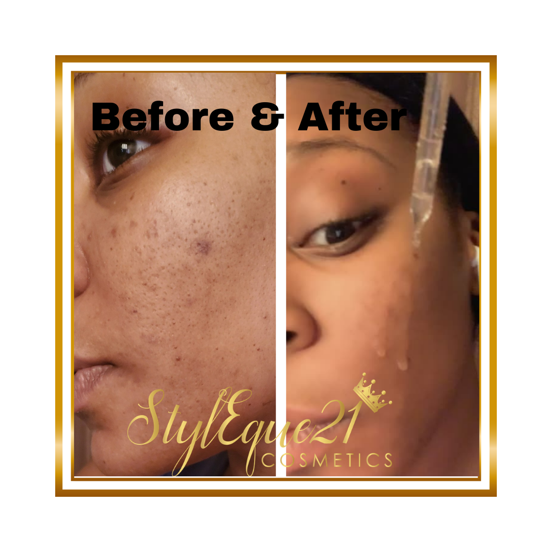 Hyaluronic Acid W- Neroli Serum