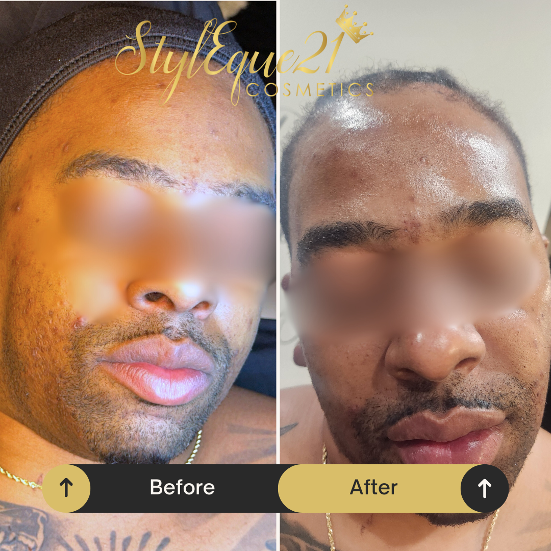 The Night Time Facial Service