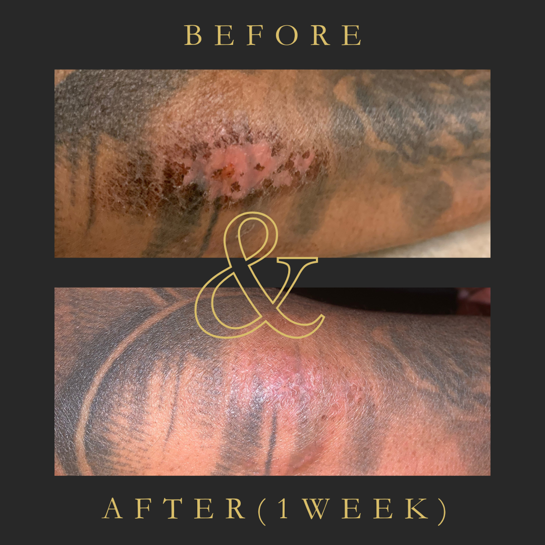 Turmeric & Ginger Oil w/ Frankincense Resin